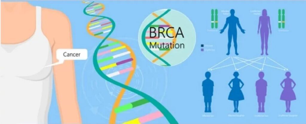 sindromul ereditar al cancerului mamar și ovarian